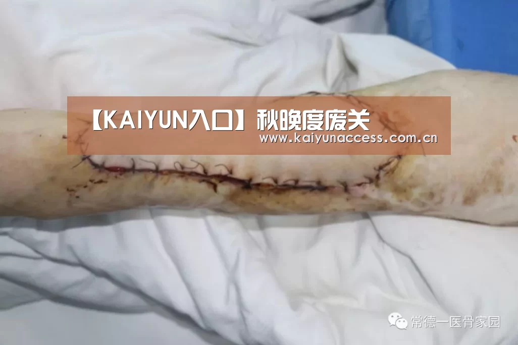 KAIYUN入口